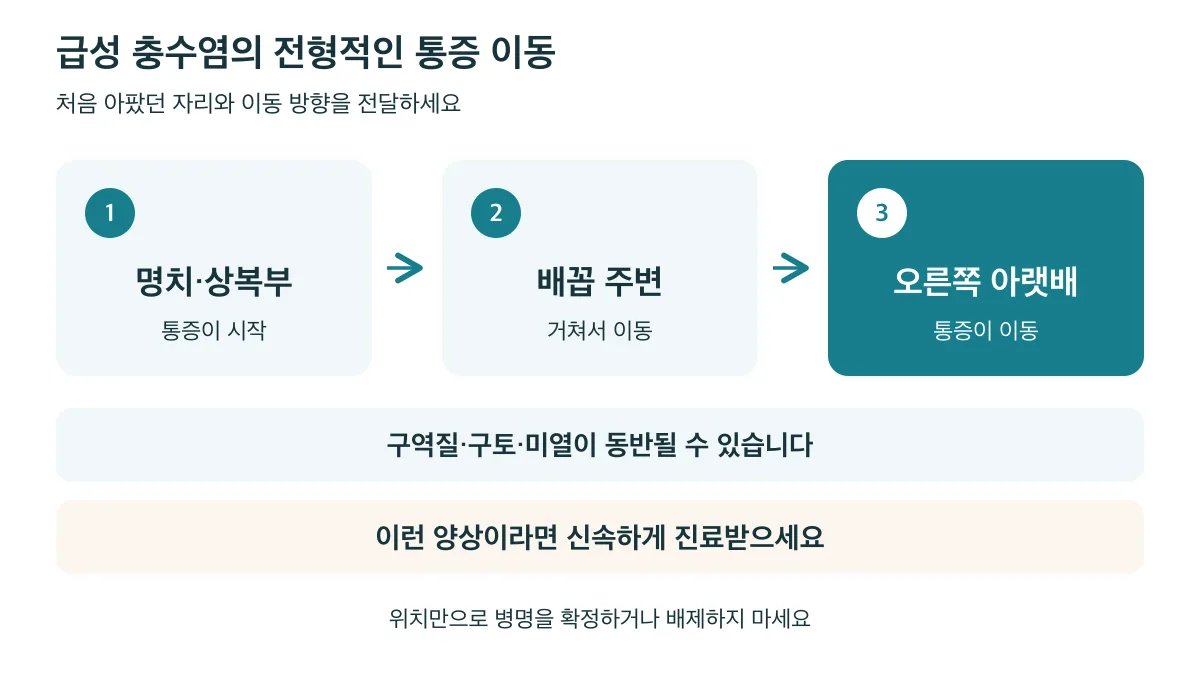 충수염에서는 명치·상복부에서 배꼽 주변을 거쳐 오른쪽 아랫배로 통증이 이동할 수 있으며 신속한 진료가 필요합니다