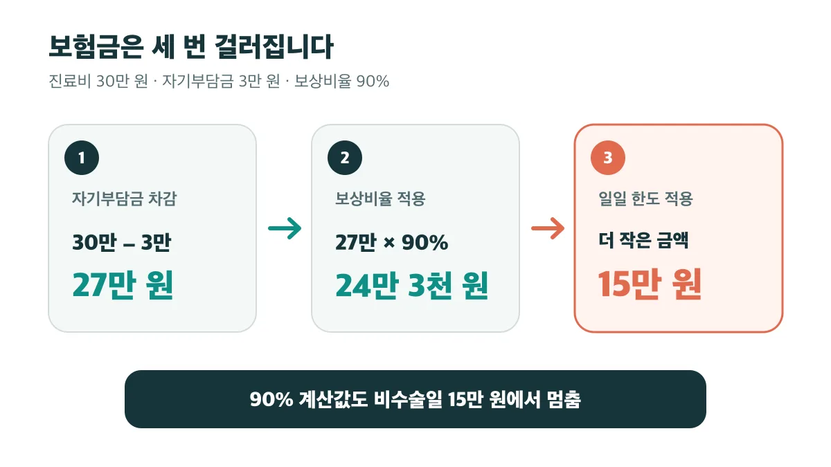 30만 원 진료비에서 자기부담금과 보상비율을 적용한 뒤 일일 한도로 15만 원이 되는 계산 순서